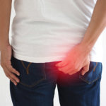 Hämorrhoiden-Cremes