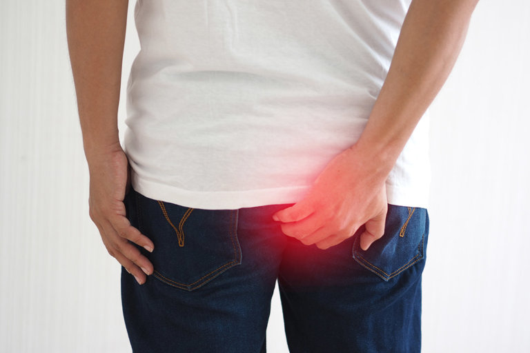 Hämorrhoiden-Cremes